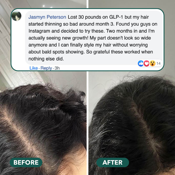 Revive Hair Gummies